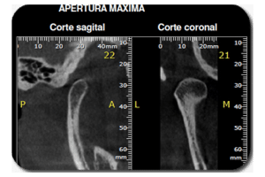 PRX Cone beam 01